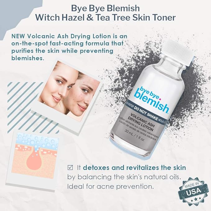 Bye Bye Blemish Drying Lotion Volcanic Ash | Acne Drying Solution To Assist With Blemish Prevention | 1 Fl. Oz.-GlimoraGlow