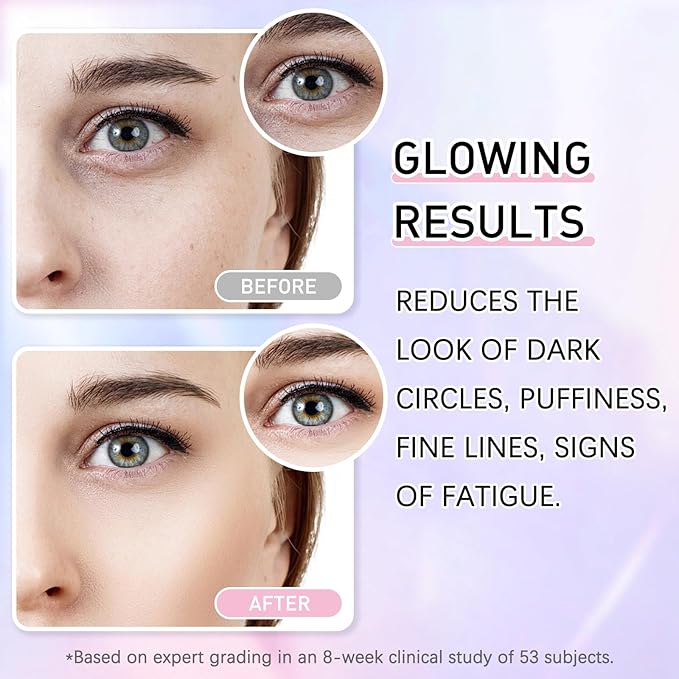 5% Caffeine Eye Cream Eye Serum Kit for Dark Circles Under Eye Treatment For Puffiness Bags And Wrinkles Eye Cream Anti Aging Eye Serum & Eye Roller 2 Fl Oz-GlimoraGlow