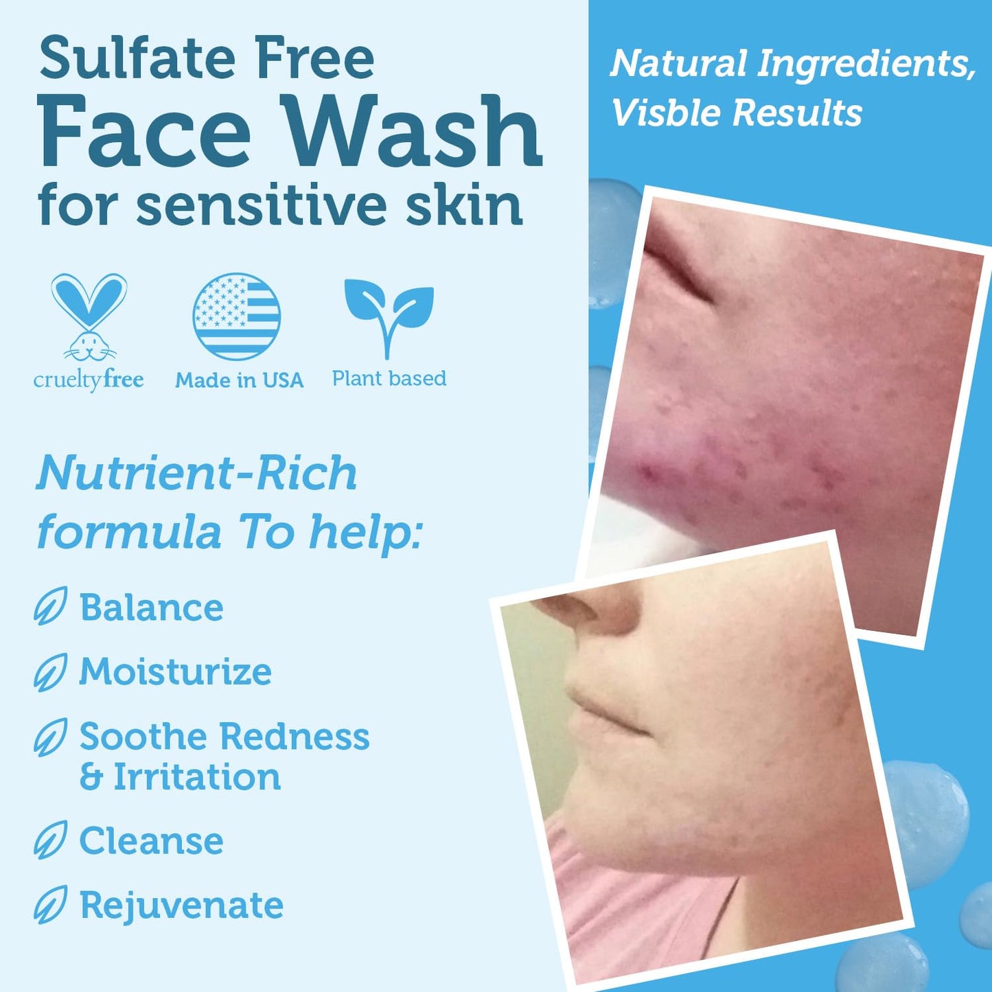 Manuka Honey Face Wash for Women and Men - Sulfate Free Moisturizing Cleanser with Organic Aloe Vera - Soothing Plus Gentle on Dry Skin Facial Cleanser Made in USA - 4oz-GlimoraGlow