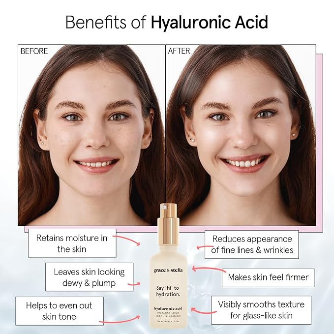grace & stella Award Winning Hyaluronic Acid Face Serum (50ml/1.7 fl oz) Removes Fine Lines & Wrinkles, Hydrating Hyaluronic Acid Serum for Face, Acido Hialuronico for Women - Vegan Skincare (2-Pack)-GlimoraGlow