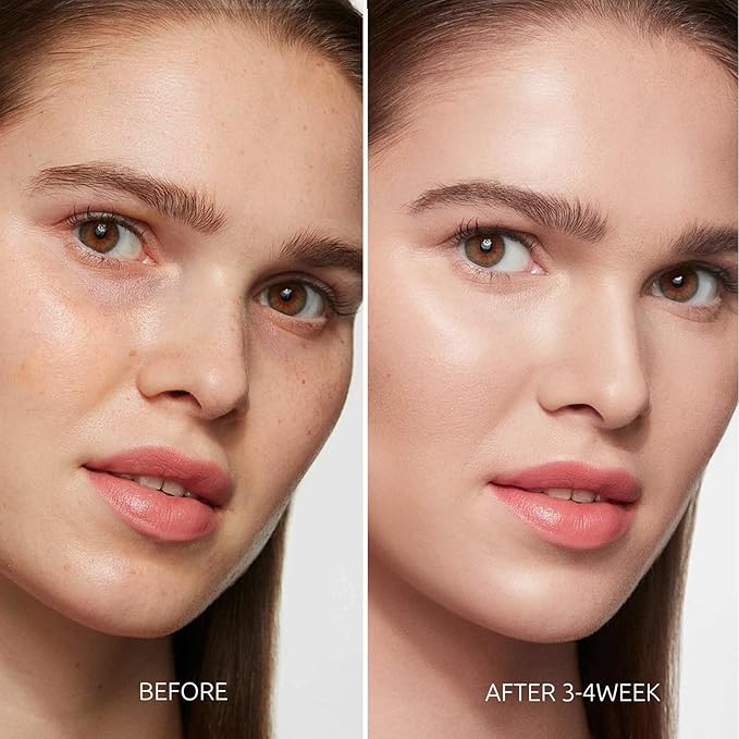 Dark Spot Remover for Face and Body - Dark Spot Corrector for Face - Sun Spots, Age Spots, Freckles & Melasma Remover - Brown Spot Corrector Evens Skin Tone for All Skin Type 1.7 Fl Oz-GlimoraGlow