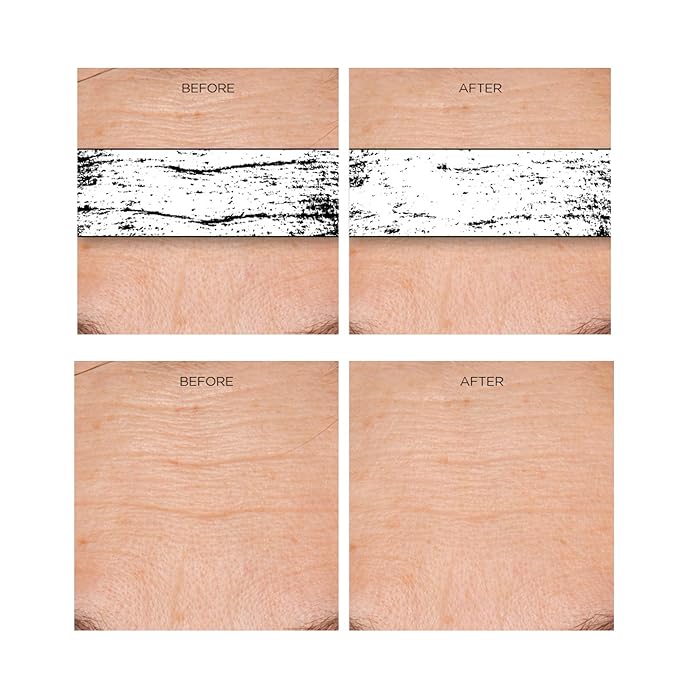 Rejuvenation Serum for Line Lifting and Crow's Feet-GlimoraGlow