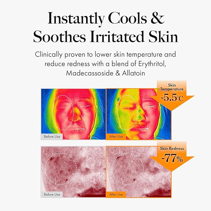 MASTINA Mastic Face Spray (1.69fl oz) Facial Mist for Natural Glow, Hydrating Formula for Dry Skin, On-the-Go Portable Korean Skin Care, Travel Summer Essentials. Mastic Gum.-GlimoraGlow