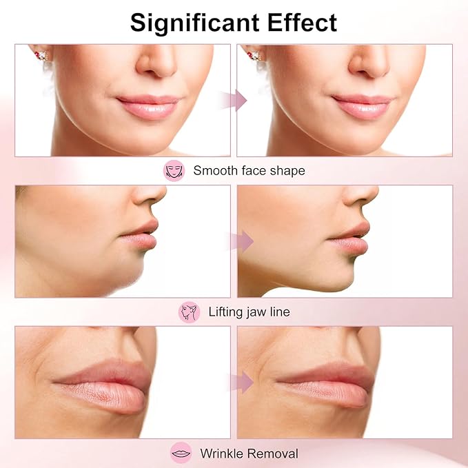 2025 Multi-Functional Face Lifting Device, V Roller Face Lift, Tightening, Skin Care, Double-Sided Roller Design, Type-C Fast Charging, Portable Beauty Device with 3 Adjustable Settings (White)-GlimoraGlow