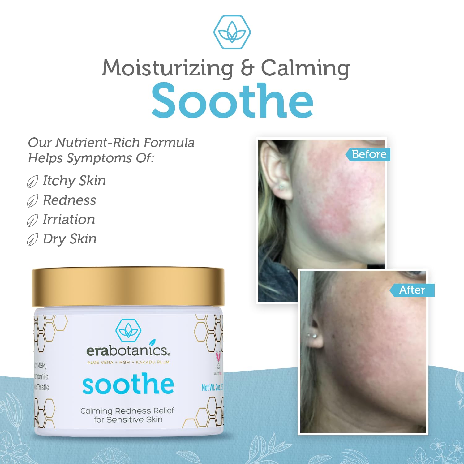 Era Organics Cream Redness Relief Moisturizer- Soothing Redness Relief for Face with Manuka Honey, MSM, Chamomile - Calming Moisturizer Made in USA-GlimoraGlow