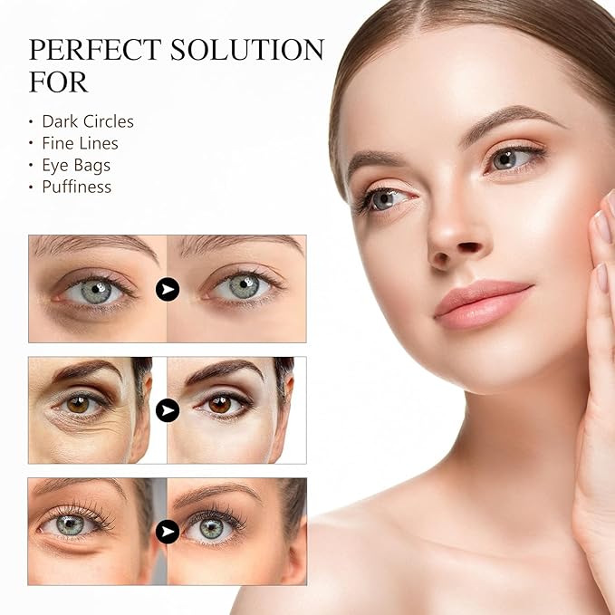 Caffeine Eye Serum Anti Aging, Eye Serum for Dark Circles and Puffiness, Retinol Eye Cream with 360°Massage Ball, Reduce Eye Wrinkles and Fine Lines-GlimoraGlow