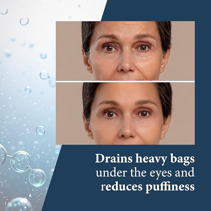 Elite Serum Rx - Anti Aging Under Eye Serum for Dark Circles and Puffiness with 8 Patented Peptides - Extra Strength Lifting and Firming Treatment for Wrinkle Repair and Eye Bag Removal-GlimoraGlow