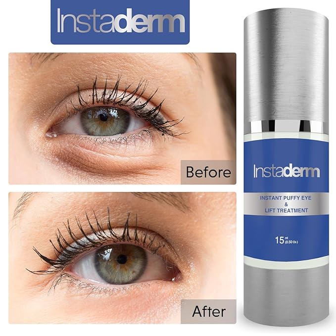 Instant Puffy Eye & Lift Treatment – Removes Under Eye Bags & Puffiness. Eliminate Dark Circles & Wrinkles. Naturally Ageless Hydrating Cream. Disappears Before Your Eyes Within Minutes.-GlimoraGlow