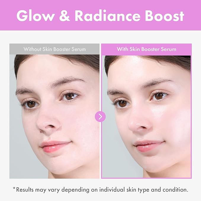 9 Peptide Skin Booster Serum, Niacinamide & Hyaluronic Acid Skin Renewal Boosting Facial Essence for All Skin Types, Korean Skin Care, Paraben Free, 150ml, 5.07 fl.oz.-GlimoraGlow