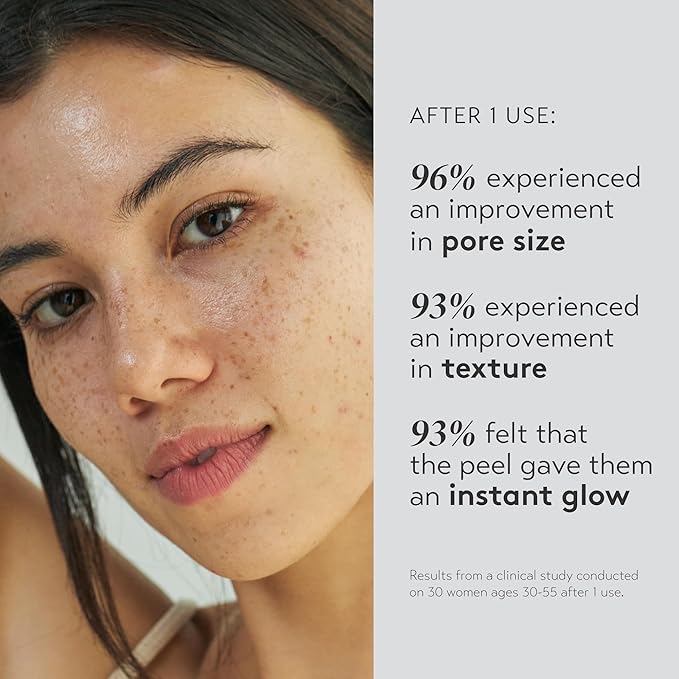 SHANI DARDEN SKIN CARE Triple Acid Peel, 2-Step Exfoliating Face Peel with Mandelic, Lactic & Glycolic Acids, Kaolin Clay Neutralizing Mask & Brush, Helps Improve Dark Spots & Skin Texture, 1.69 fl oz-GlimoraGlow