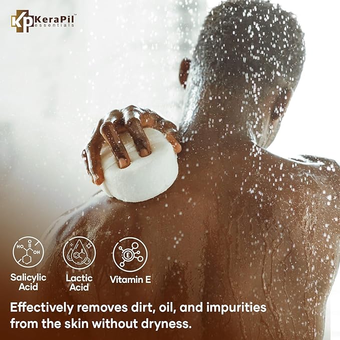 Exfoliating Body Wash with Salicylic Acid - No Dry Out, Gentle Exfoliates Rough and Bumpy Skin, Body Acne Wash, BHA & AHA - Coconut and Vanilla Salicylic Acid Body Wash - (16 fl oz x 2)-GlimoraGlow