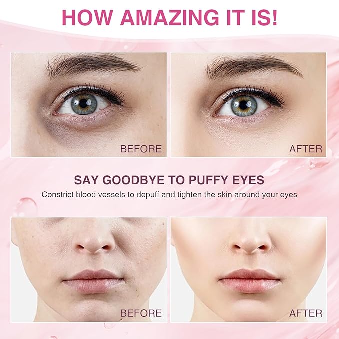 Facial Ice Roller for Skin Care - Aluminum Face Roller to De-Puff, Soothe & Tighten Pores - Cold Therapy Massage Tool for Radiant Glow-GlimoraGlow