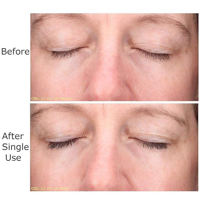 Hydrate & Soothe Beauty Collection, Activator with Awaken Facial & Vitamin B Concentrate, Face smoothing moisturizer, Skin Care Routine, For All Skin Type, Gift Bundle / Starter Kit-GlimoraGlow