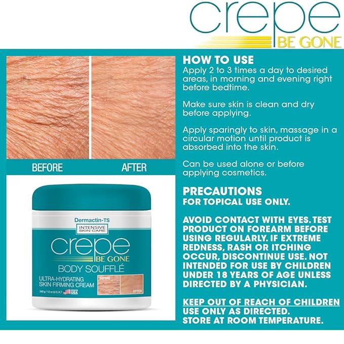 Crepe Be Gone Body Souffle Classic - Large 12 ounce - Ultra Hydrating Crepe Skin Firming Cream for Neck,Chest, Arms & Legs-GlimoraGlow