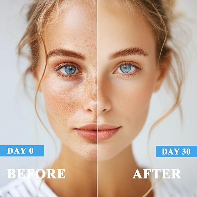 Dark Spot Remover for Face and Body, Dark Spot Corrector, Age Spot Sun Spot Freckles Dark Spot Remover, Melasma Treatment for Face, Advanced Skin Care Cream for Women and Men (1.7 Fl Oz)-GlimoraGlow