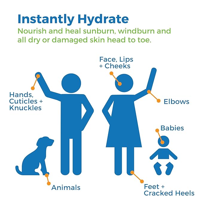 Waxhead Aftersun Body Butter for Sunburn Relief - Also great Tattoo Balm, Eczema Cream for Kids Adults, After Sun Lotion, Sunburn Treatment, Healing Salve-GlimoraGlow