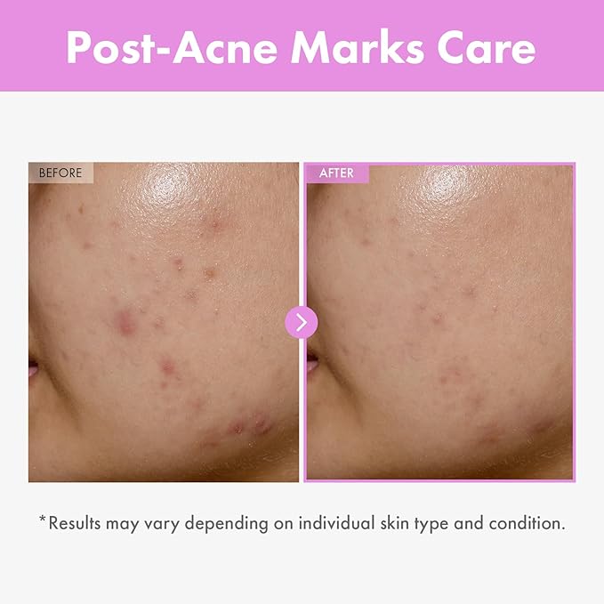 9 Peptide Skin Booster Serum, Niacinamide & Hyaluronic Acid Skin Renewal Boosting Facial Essence for All Skin Types, Korean Skin Care, Paraben Free, 150ml, 5.07 fl.oz.-GlimoraGlow