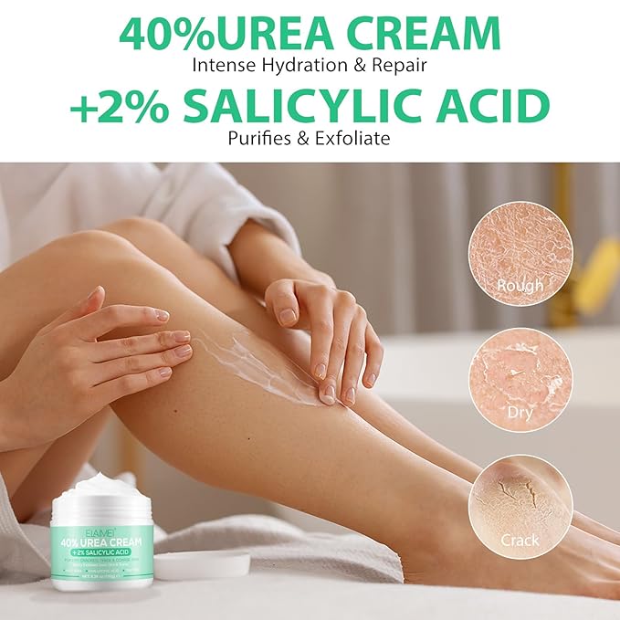 J&H Jasmine&Hyacinth 40% Urea Cream with 2% Salicylic Acid, Aloe, Feet/Heel Cream Moisturizer for Dry Cracked Heel, Knees, Elbows, Hands, Callus Remover, Intensive Hydrating Treatment-5.3 OZ/150 G-GlimoraGlow