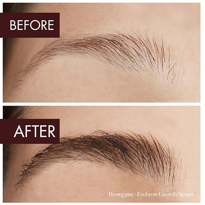 Eyebrow Growth Serum - Provides Full, Healthy And Well Defined Eyebrows - High Technology Formula - Vegan And Cruelty Free - Flexible Applicator Developed Specifically For Brows - 0.1 Oz-GlimoraGlow