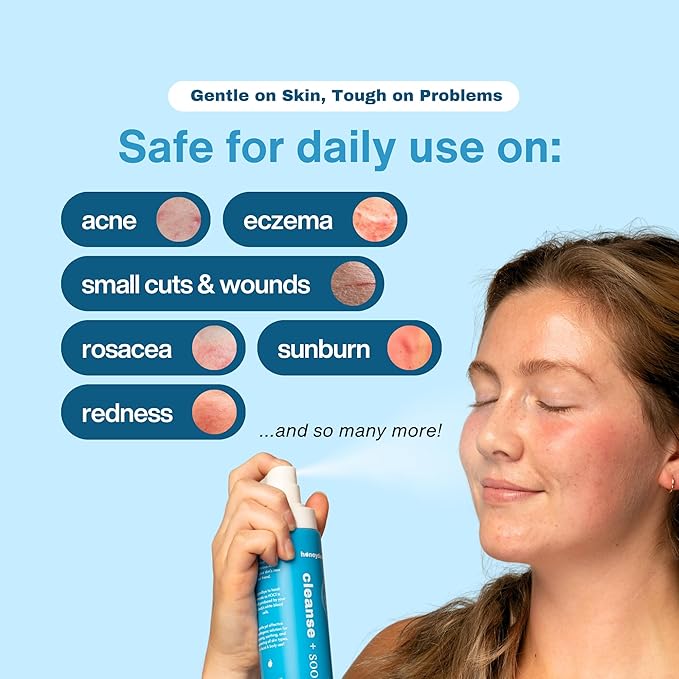 Hypochlorous Acid Spray – HOCl Face & Body Mist for Acne, Eczema & Irritation – Multi-Purpose Skin Repair – Eyelid Cleanser, Post-Workout/Procedure, Scalp & Sensitive Skin (2 oz+6.8 oz)-GlimoraGlow