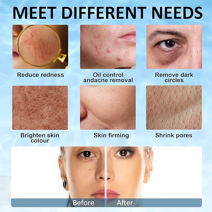 Ice Face Roller, Joyeee Silicone Ice Roller For Face and Eyes Puffiness Relief Reusable Face Ice Cubes Migraine Pain Relief Facial Ice Mold Skincare Tools Gifts for Women Beauty-GlimoraGlow