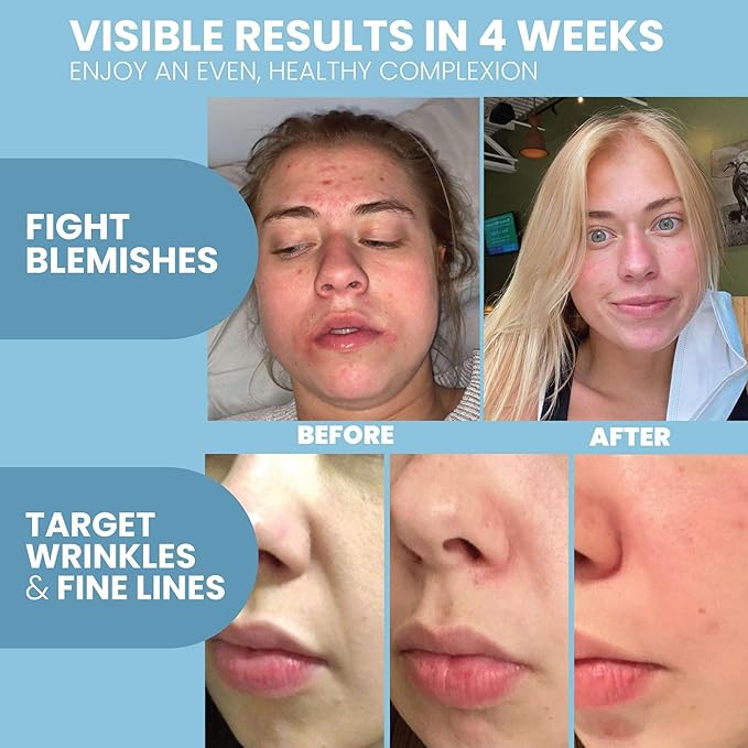 Eva Naturals Retinol Serum for Face – Anti Aging Night Serum with Hyaluronic Acid, Vitamin E, Witch Hazel, Aloe – Wrinkle Moisturizer, Dark Spot Corrector, Acne Scar Treatment, Skin Brightening – 2oz-GlimoraGlow