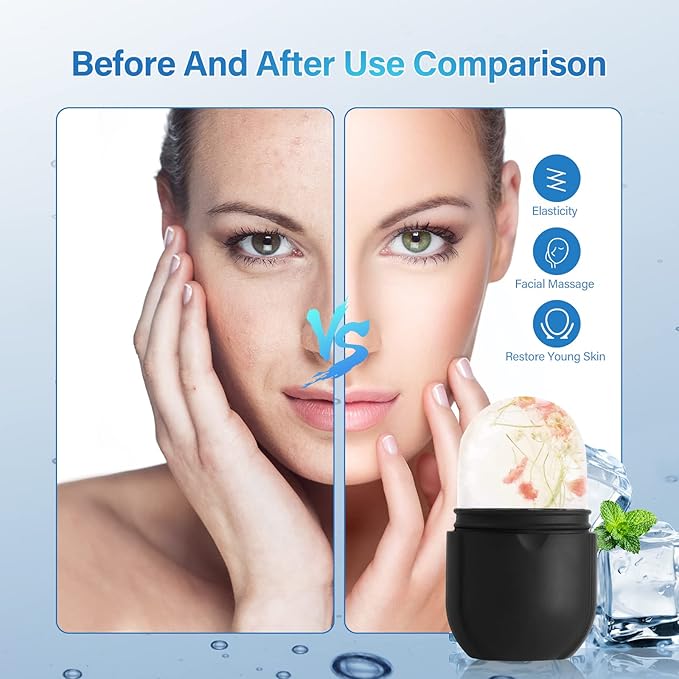 Ice Roller for Face Eye, Ice Roller Mold Face Skin Care Kit for Brighten Skin and Enhance Your Natural Glow Remove Fine Lines Shrink Pores Reduce Acne and Lubricate the Skin (Black)-GlimoraGlow