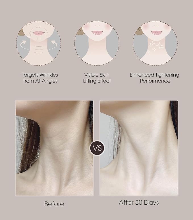 Intelligent Neck Lifting Device, 3 Color LED Neck Massager with Remote Control for Facial Massager | at Home Skin Care Tool-GlimoraGlow