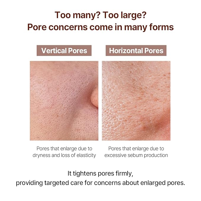 AVCA Pore Fit Retinol Ampoule for Large Pores, Fine Lines, Anti Aging & Wrinkle Care 100ml/3.38fl. oz.-GlimoraGlow