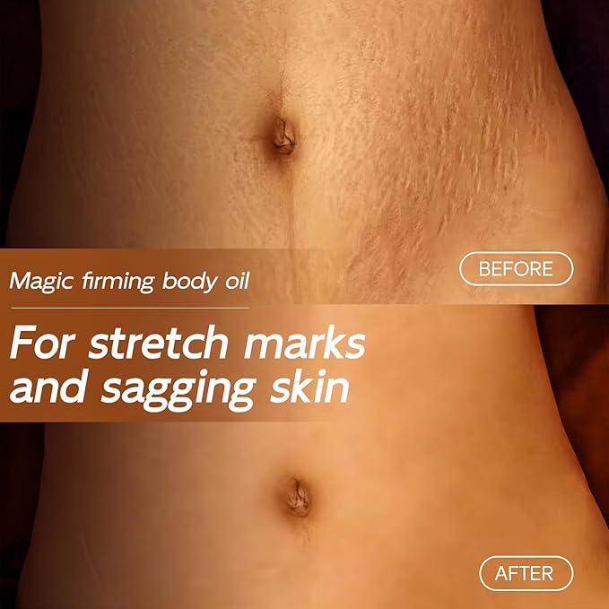 Magic Body Firming Oil, 3.38 FL OZ, Korean Skin Care Post-Shower Body Oil for Women – With 767,000ppm Jojoba Oil,to Tighten, Hydrate & Nourish Dry Skin, Lightweight & Non-Greasy for Full Body Use-GlimoraGlow