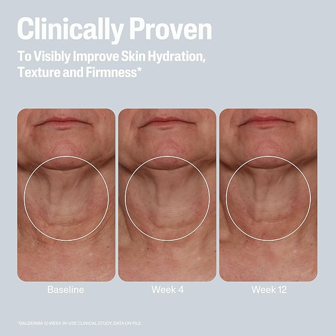 Cetaphil Skin Activator Hydrating & Firming Body Cream 12oz, Mandelic Acid (AHA) and Centella Asiatica (CICA) Cream, Hydrates and Firms Aging Skin, Anti-Aging Skin Care, 12 oz-GlimoraGlow