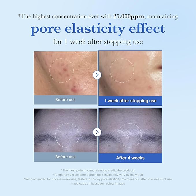 medicube Zero Exosome Shot 25,000 PPM Spicule Facial Serum | Liquid Skin Booster Serum | Exosome, AHA+BHA+PHA | Pore Care, Dead Skin Cells, Skin Texture | Korean Skin Care 0.43 fl.oz-GlimoraGlow