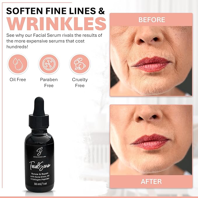 Facial Serum - Fight Blemishes - Acne Pimples & Breakouts - Soften Fine Lines & Wrinkles - Hydrate & Repair Damaged Skin - Clear Complexion - Collagen - 2 Types of Hyaluronic Acid - Anti Aging - 1oz-GlimoraGlow