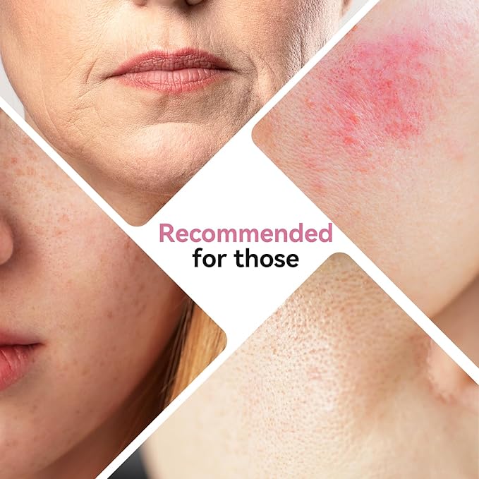 ISTON Bio-Collagen Face Mask,Overnight Revitalizing Hydrating Face Mask for Glowing Skin | Visible Firming, Deep Hydration & Refined Pores | Peptides, NMN & Hyaluronic Acid Masks For All Skin Type-GlimoraGlow