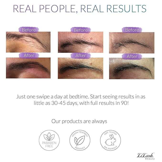 LiBrow Purified Eyebrow Physician-Formulated Serum for Fuller & Thicker Looking Eyebrows | Natural Eyebrow Enhancer Safe for Sensitive Skin | 90-Day Supply (3ml)-GlimoraGlow