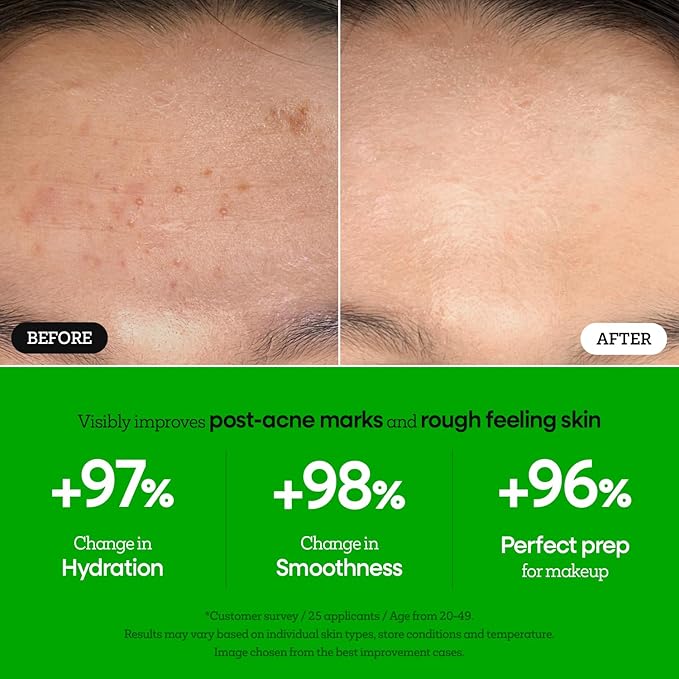 Nature Republic The First Peptide Boosting Serum, 8 Peptides, Niacinamide & Triple Hyaluronic Acid Complex,17 Amino acids,for All Skin Types, Korean Skin Care150ml/5.07 fl oz-GlimoraGlow