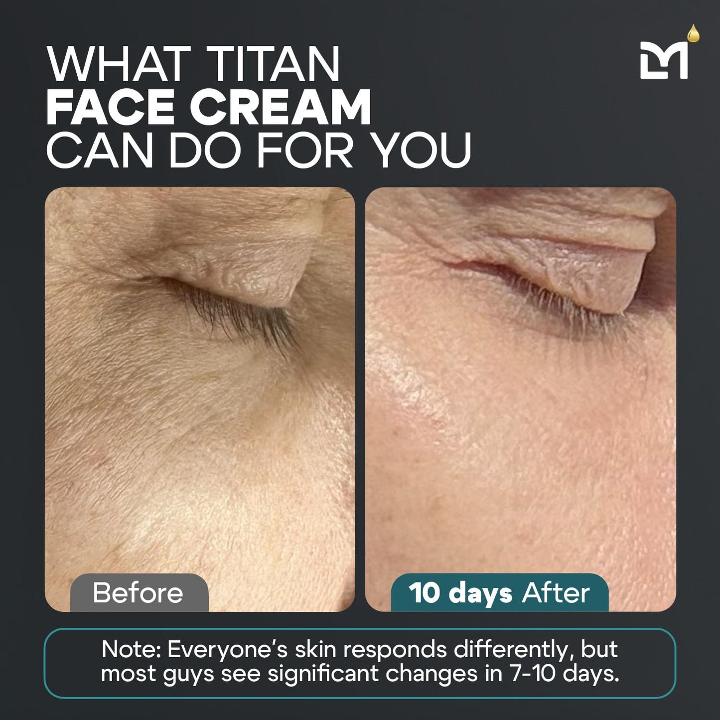 Titan Anti-Aging Mens Face Cream – Mens Face Moisturizer – For Men, Face Lotion – Men, Skin Care – Tighten, Tone, Revitalize – Ceramides, Vitamin C & E, Squalane – All Skin Types – Unscented-GlimoraGlow