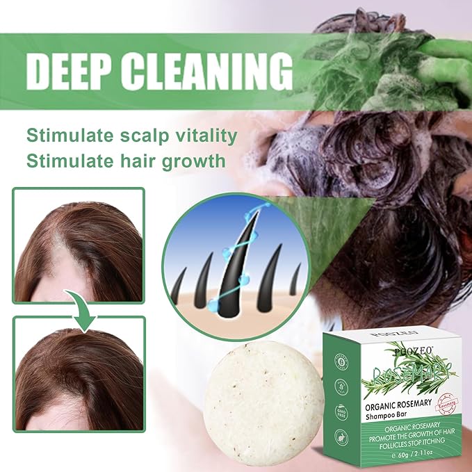 2 Pack Rosemary Hair Shampoo Bar,Deep Cleansing for Scalp Hair Loss Shampoo Soap,Organic Hair Oil Control,Solid Shampoo for Hair Growth, Refreshing and Hydrating Soap for Stocking Stuffers Women Gifts-GlimoraGlow