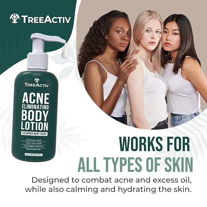 TreeActiv Acne Eliminating Body Lotion 8 fl oz | Clears Body, Back, Butt and Shoulder Acne | Anti-Acne Moisturizer | Prevents Future Breakouts | Cucumber Mint Scent-GlimoraGlow