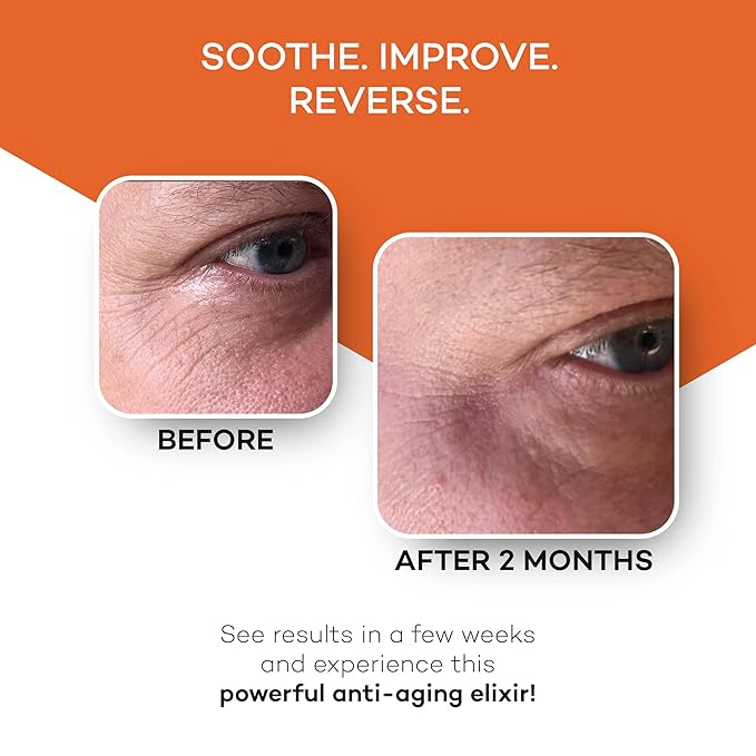 Zocufill Elixir Eye Gel and Face Serum - Eye Bags Treatment for Women and Men - Reduce the Appearance of Dark Circles, Puffy Eyes, Fine Lines and Wrinkles-GlimoraGlow