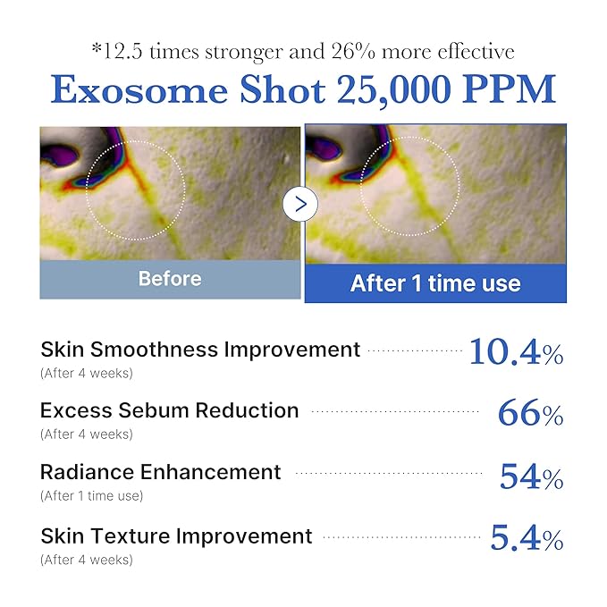 medicube Zero Exosome Shot 25,000 PPM Spicule Facial Serum | Liquid Skin Booster Serum | Exosome, AHA+BHA+PHA | Pore Care, Dead Skin Cells, Skin Texture | Korean Skin Care 0.43 fl.oz-GlimoraGlow