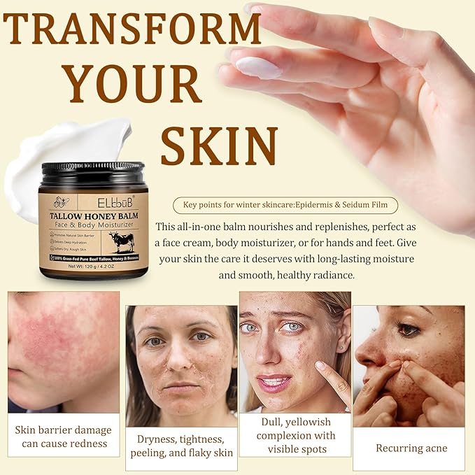 Whipped Tallow Cream for Face & Body - 100% Grass-Fed Beef Tallow, Natural Honey & Beeswax Moisturizer, Deep Hydration & Nourishment, Oil-Free & Unscented, Fast Absorbing-GlimoraGlow