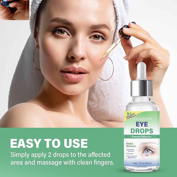 Stye Eye Treatment, Stye Eye Drops Serum for Styes Chalazion and Blepharitis, Chalazion Remover Fast Relief, Restore Healthier Eye Skin, 30ml-GlimoraGlow