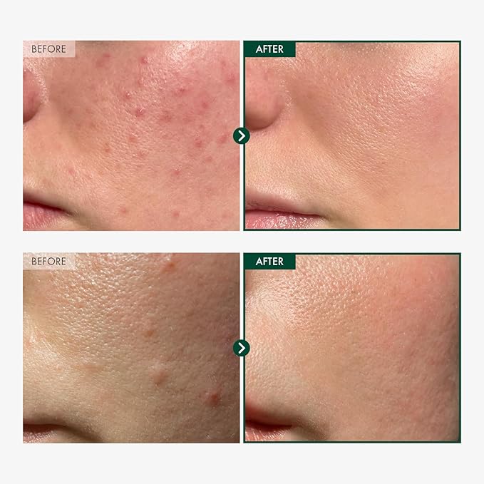 Madagascar Centella 86% Ampoule with 860,048ppm Centella Asiatica, Soothing, Calming, Facial Serum for face, for All Skin Types, Korean Skin Care, 100ml, 3.38 fl.oz.-GlimoraGlow