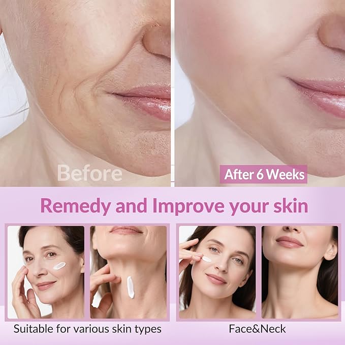 Neck Firming Creams for Tightening and Firming, Moisturizer Face Cream with Collagen, Hyaluronic Acid, Day & Night Anti-Aging Skin Tightening Cream Neck, Décolleté & Face – 1.7Fl Oz-GlimoraGlow