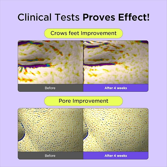 BY WISHTREND Vitamin A-mazing Bakuchiol Night Cream | Retinal, Peptide, Collagen, Ceramide NP, Centella Asiatica, moistfully plump overnight skincare (1.05 Ounce (Pack of 1))-GlimoraGlow