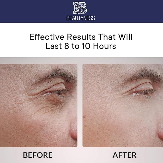 Instant Ageless Eye Cream – Anti Wrinkle Cream, Removes Under Eye Puffiness, Bags, Expression Lines, & Dark Circles. Powerfully Tighen & Lifts Sagging Skin. Disappears Before Your Eyes In Minutes.-GlimoraGlow