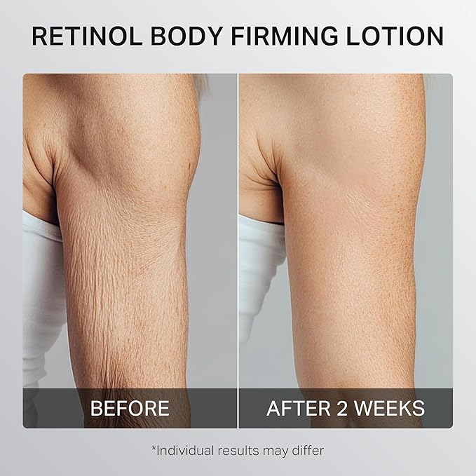 Ultra-Size Firming Retinol Body Lotion for Crepey Skin & Keratosis Pilaris with 0.05% Retinol, AHA, Collagen, Body Cream, Anti Aging Moisturizer 10.14 fl oz-GlimoraGlow