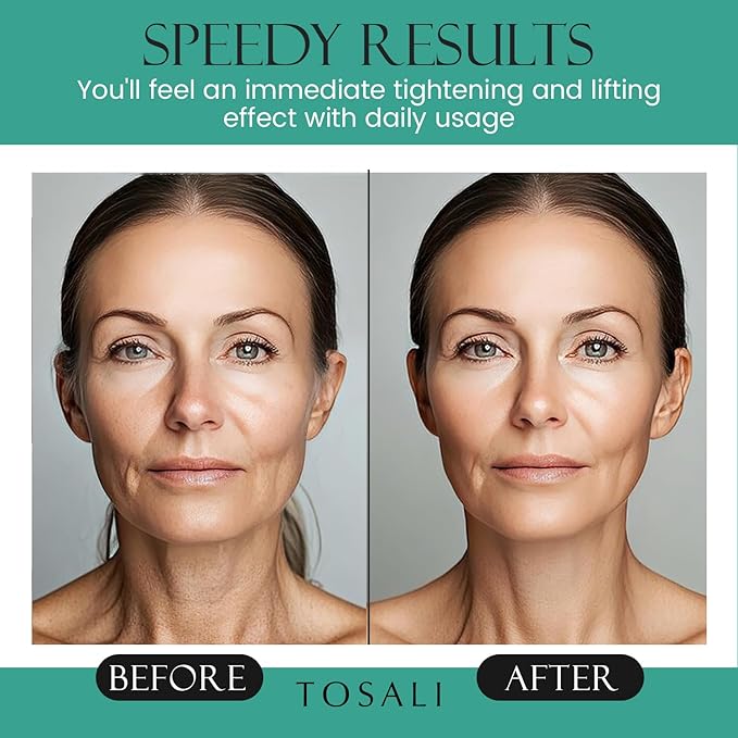 Anti Aging Face Cream for Women, 1.7 oz - Niacinamide Cream, Hydrating Face Moisturizer with Multivitamins - Day & Night Cream for Face with Anti Aging Effect, Skin Care for All Skin Types-GlimoraGlow