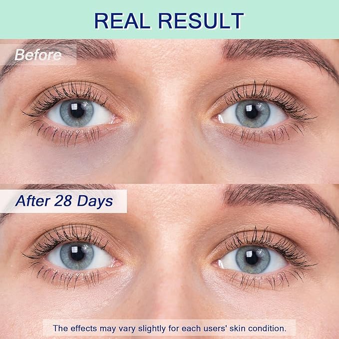 Eye Serum for Dark Circles, 5% Caffeine Under Eye Cream for Wrinkles, Morning Puffiness and Fine Lines, Deeply Repairs the Muscles Around the Eyes with 360°Massage Ball, 0.5 Fl Oz-GlimoraGlow